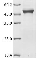 Mouse Extracellular tyrosine-protein kinase PKDCC (Pkdcc) Recombinant Protein - BioCrest Sci