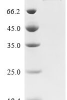 Human Wee1-like protein kinase (WEE1) Recombinant Protein, C-His - BioCrest Sci