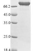 Human Protein-arginine deiminase type-4 (PADI4) Recombinant Protein - BioCrest Sci