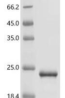 Adelphocoris lineolatus Odorant-binding protein 1 Recombinant Protein - BioCrest Sci
