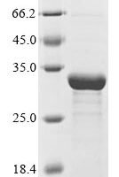 Bacillus subtilis subsp. natto Subtilisin NAT (aprN) Recombinant Protein - BioCrest Sci
