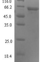 Human Protein ABHD18 (ABHD18) Recombinant Protein, N-His-SUMO - BioCrest Sci