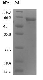 Human Protein ABHD18 (ABHD18) Recombinant Protein, N-His-SUMO, Homo sapiens (Human), E.coli, N-terminal 6xHis-SUMO-tagged, 60.1 kDa, purity >≥ 90% as determined by SDS-PAGE.