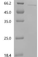 Malus domestica 1-aminocyclopropane-1-carboxylate synthase (ACS-1) Recombinant Protein - BioCrest Sci
