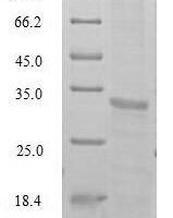 Human Testisin (PRSS21) Recombinant Protein - BioCrest Sci