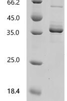 Mouse Stromal cell-derived factor 1 (Cxcl12) Recombinant Protein - BioCrest Sci