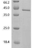 Human Elongator complex protein 3 (ELP3) Recombinant Protein, C-His, aa 1–547, Yeast - BioCrest Sci