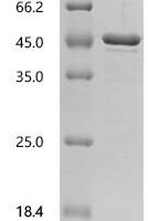 Human Lymphocyte antigen 6 complex locus protein G6c (LY6G6C) Recombinant Protein, N-His-SUMOstar - BioCrest Sci