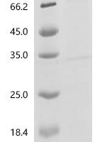 Human Acetylcholine receptor subunit alpha (CHRNA1), partial Recombinant Protein, N-His-PDI, aa 21–255, E.coli - BioCrest Sci