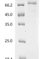 Human Protein-arginine deiminase type-6 (PADI6) Recombinant Protein - BioCrest Sci