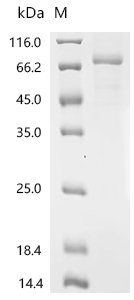 Human Protein-arginine deiminase type-6 (PADI6) Recombinant Protein, Homo sapiens (Human), Mammalian cell, C-terminal 10xHis-tagged, 79.1 kDa, purity >≥ 85% as determined by SDS-PAGE.