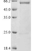Human Atrial natriuretic peptide receptor 3 (NPR3), partial Recombinant Protein, C-His-Myc - BioCrest Sci