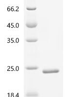 Human Bromodomain-containing protein 2 (BRD2), partial Recombinant Protein, C-His - BioCrest Sci