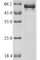 Arabidopsis thaliana Probable carotenoid cleavage dioxygenase 4, chloroplastic (CCD4), partial Recombinant Protein - BioCrest Sci