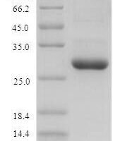 Mouse Protein S100-A9 (S100a9) Recombinant Protein - BioCrest Sci
