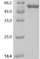 Human Sodium/potassium-transporting ATPase subunit alpha-2 (ATP1A2), partial Recombinant Protein, C-His - BioCrest Sci