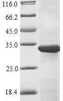 Mouse Immunoglobulin superfamily member 2 (Cd101), partial Recombinant Protein - BioCrest Sci