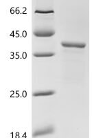 Lolium perenne Major pollen allergen Lol p 5a (LOLPIB) Recombinant Protein, N-His - BioCrest Sci