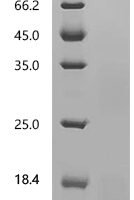 Bovine Interleukin-4 (IL4) Recombinant Protein, C-His, aa 25–135, Bos taurus (Bovine) - BioCrest Sci