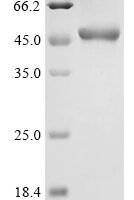 Human E3 ubiquitin-protein ligase HUWE1 (HUWE1), partial Recombinant Protein - BioCrest Sci