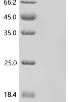 Human Reduced folate transporter (SLC19A1)-Detergent Recombinant Protein - BioCrest Sci