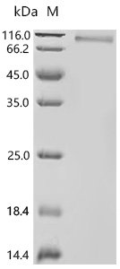 Human Reduced folate transporter (SLC19A1)-Detergent Recombinant Protein, Homo sapiens (Human), Mammalian cell, N-terminal 10xHis-tagged and C-terminal Twin-Strep-tagged, 69.4 kDa, purity >≥ 95% as determined by SDS-PAGE.