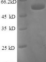 Human Tissue factor pathway inhibitor (TFPI), partial Recombinant Protein - BioCrest Sci