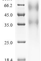 Human Transcriptional regulator ERG (ERG) Recombinant Protein, N-His, Isoform 2 - BioCrest Sci