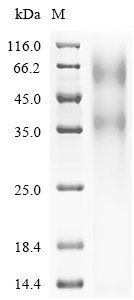 Human Transcriptional regulator ERG (ERG) Recombinant Protein, N-His, Isoform 2, Homo sapiens (Human), Yeast, N-terminal 6xHis-tagged, 56.6 kDa, purity >≥ 90% as determined by SDS-PAGE.