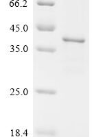 Mouse Fibroblast growth factor 5 (Fgf5) Recombinant Protein, C-His - BioCrest Sci