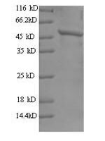 Human Tyrosine-protein kinase JAK2 (JAK2), partial Recombinant Protein, N-His - BioCrest Sci