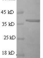 Mouse CD63 antigen (Cd63), partial Recombinant Protein - BioCrest Sci