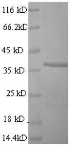Mouse CD63 antigen (Cd63), partial Recombinant Protein, Mus musculus (Mouse), E.coli, N-terminal GST-tagged, 38.5 kDa, purity >≥ 90% as determined by SDS-PAGE.