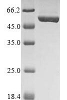 Mouse Cytoskeleton-associated protein 4 (Ckap4), partial Recombinant Protein, N-10His/C-Myc, aa 109–575, Mammalian cell - BioCrest Sci
