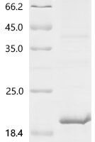 Human Clarin-1 (CLRN1), partial Recombinant Protein - BioCrest Sci