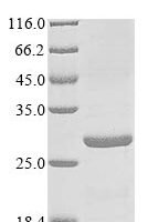 Mycobacterium tuberculosis PP2C-family Ser/Thr phosphatase (pstP), partial Recombinant Protein, Tag-Free - BioCrest Sci