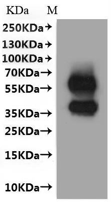 Rat Membrane spanning 4-domains A1 (Ms4a1)-VLPs Recombinant Protein, Rattus norvegicus (Rat), Mammalian cell, C-terminal 10xHis-tagged, 34.1 kDa, purity >≥ 95% as determined by SEC-HPLC.