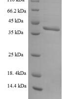 Human U2 small nuclear ribonucleoprotein B (SNRPB2) Recombinant Protein - BioCrest Sci