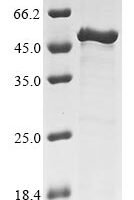 Mycoplasma pneumoniae Uncharacterized protein MG218.1 homolog (MPN_311) Recombinant Protein - BioCrest Sci