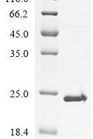 Human Ribonuclease 3 (DROSHA), partial Recombinant Protein - BioCrest Sci