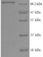 Human Eyes absent homolog 2 (EYA2) Recombinant Protein - BioCrest Sci