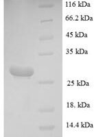 Mouse Mast cell protease 4 (Mcpt4) Recombinant Protein, N-His, aa 21–246, E.coli - BioCrest Sci