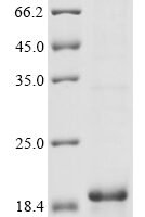 Human G-protein coupled receptor family C group 5 member D (GPRC5D), partial Recombinant Protein - BioCrest Sci