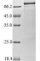 Human Nuclear body protein SP140-like protein (SP140L) Recombinant Protein - BioCrest Sci