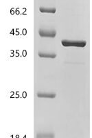 Human Polymerase delta-interacting protein 2 (POLDIP2) Recombinant Protein - BioCrest Sci