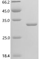 Ricinus communis Ricin, partial Recombinant Protein, N-His - BioCrest Sci