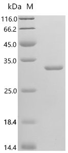 Ricinus communis Ricin, partial Recombinant Protein, N-His, Ricinus communis (Castor bean), E.coli, N-terminal 6xHis-tagged, 33.1 kDa, purity >≥ 95% as determined by SDS-PAGE.