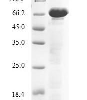 Human Ecto-NOX disulfide-thiol exchanger 2 (ENOX2) Recombinant Protein - BioCrest Sci