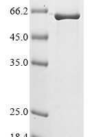 Human Extended synaptotagmin-2 (ESYT2), partial Recombinant Protein - BioCrest Sci