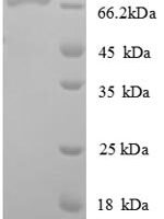 Escherichia coli DNA ligase (ligA) Recombinant Protein - BioCrest Sci